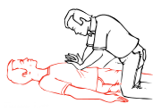 If the casualty is unconscious, place him face upwards, keeping the chin well up and the neck bent backwards.