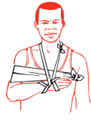 bend the elbow gently and apply a collar and cuff sling