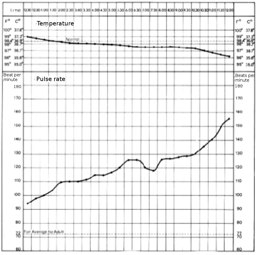 falling temperature and the rising pulse rate