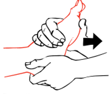 first apply traction by pulling the limb gently and firmly away from the body before attempting to move it