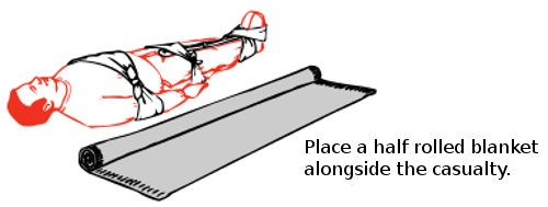 tie a narrow fold bandage around the casualty at the level of his elbows and mid thighs